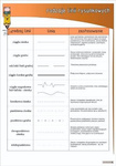 Rodzaje lini rysunkowych  -schematy poglądowe